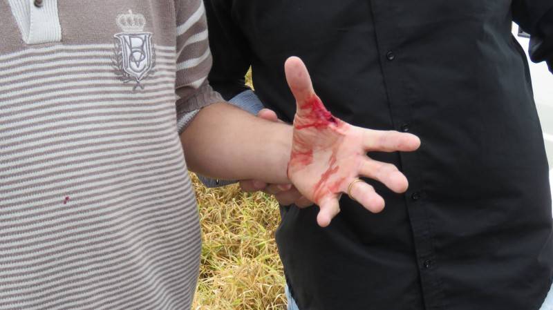 Vice-prefeito é atingido por disparo em tentativa de homicídio — foto 2