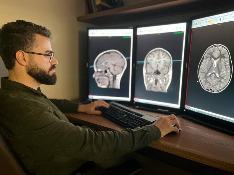 Ressonância Magnética: exame é fundamental para avaliação de casos de epilepsia — foto 1