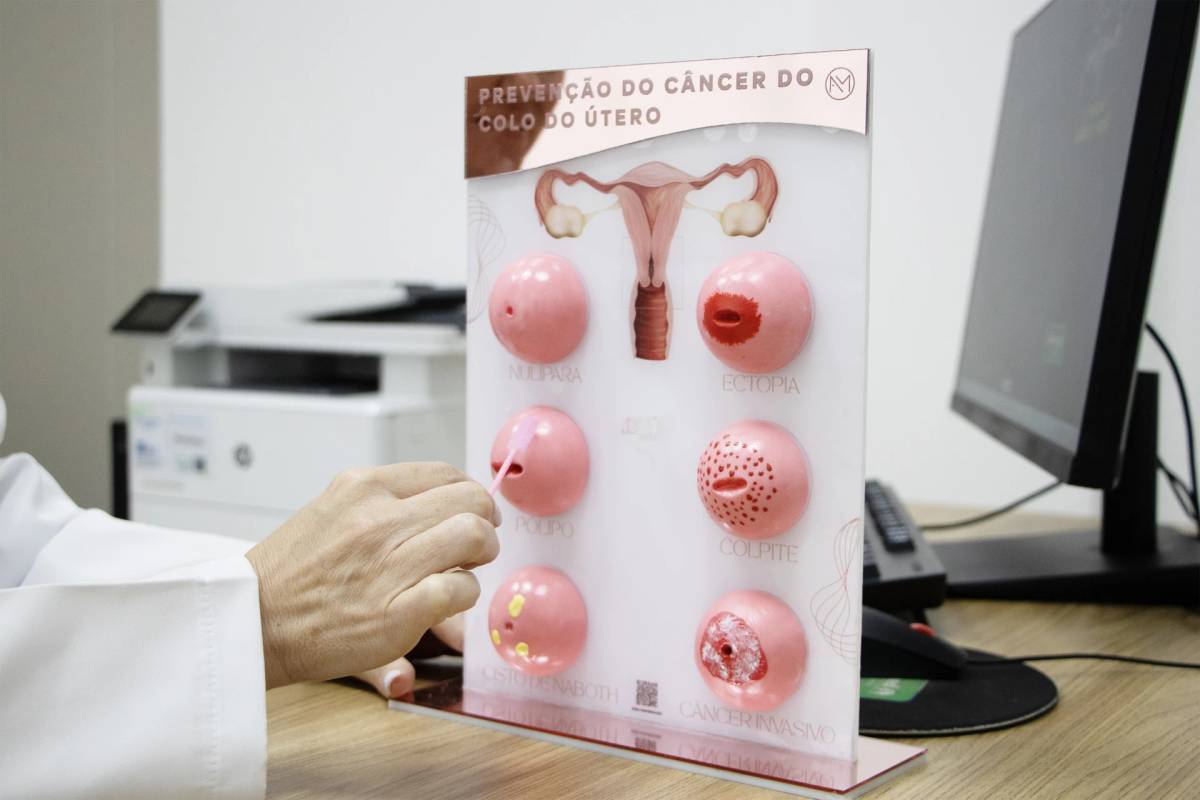 Unimed Criciúma reforça prevenção ao câncer de colo do útero — foto 3