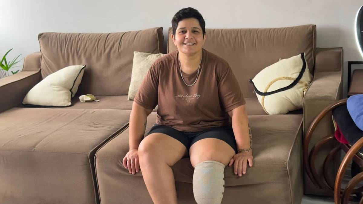 Após perder parte da perna por uma infecção rara, moradora de Criciúma busca apoio para recomeçar — foto 3
