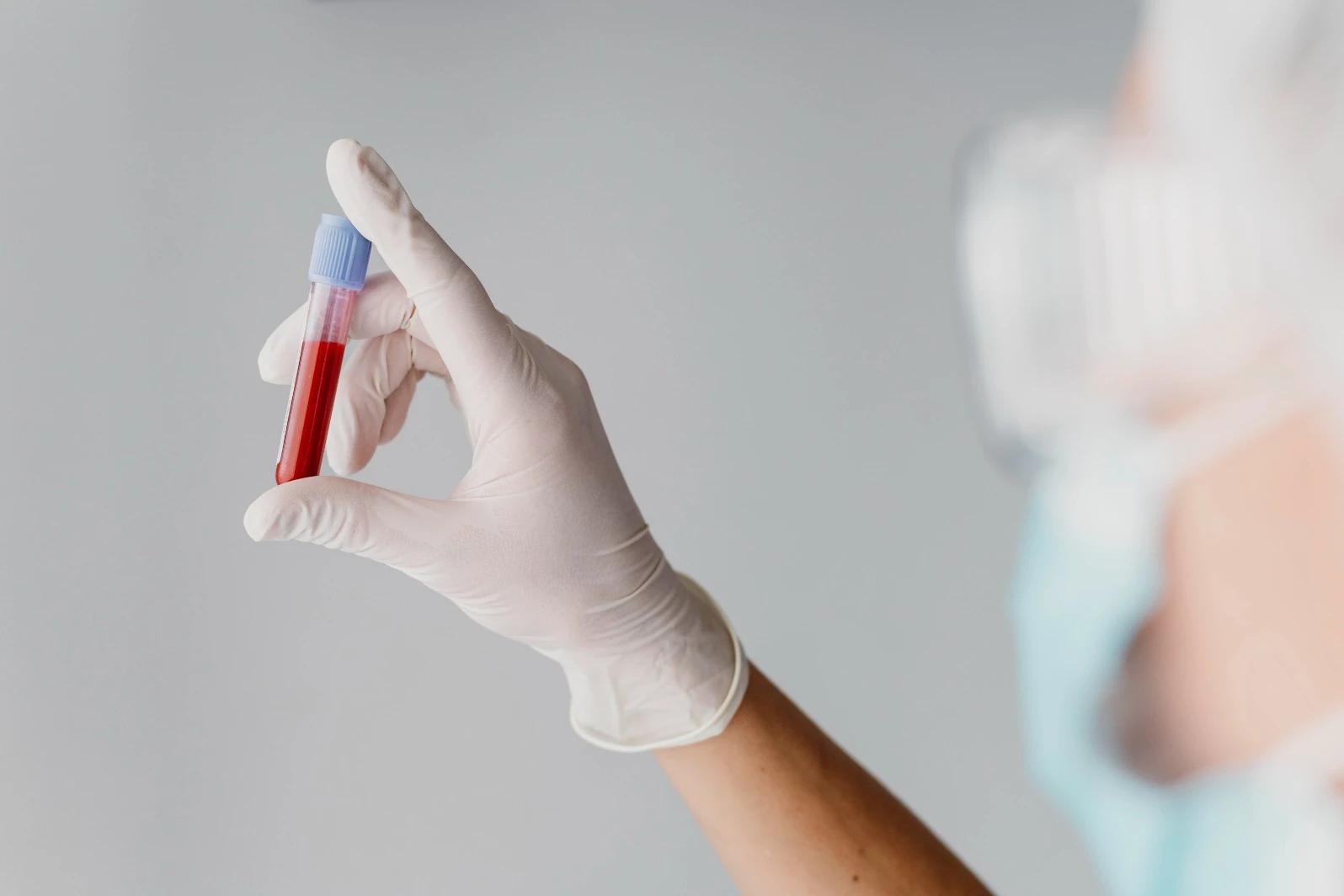 Secretário explica paralisação de atendimento via SUS em laboratório de Criciúma