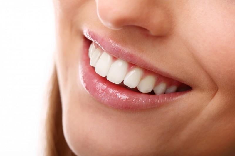 Projeto Sorrisação: Siderópolis iniciará entrega de próteses dentárias na segunda-feira