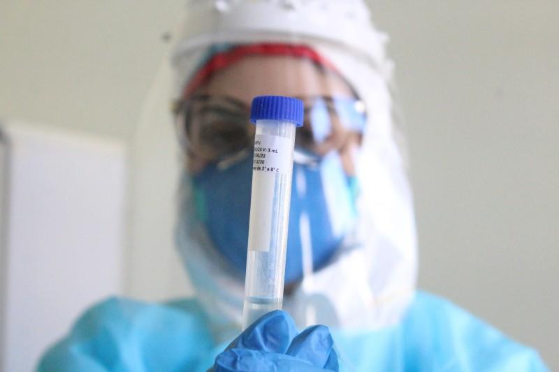 Santa Catarina confirma 43.031 casos e 497 mortes por Covid-19