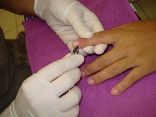 Cocal do Sul realiza campanha contra a Hepatite C