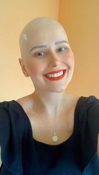 Moradora de Criciúma precisa de ajuda para realizar quarta cirurgia 