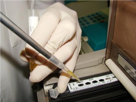 Produção de anticorpos do HIV pode iniciar em três semanas após o contato com o vírus