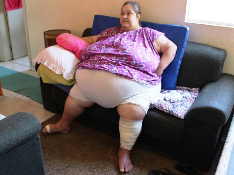 O drama de pesar 220 quilos aos 62 anos