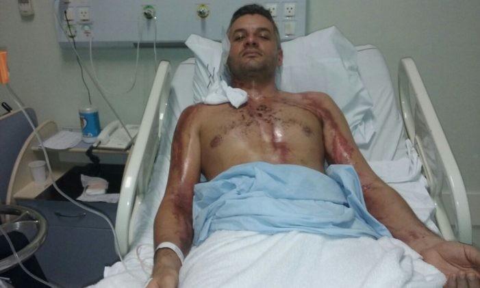 Motociclista se recupera após ser atingido por um raio na BR-101
