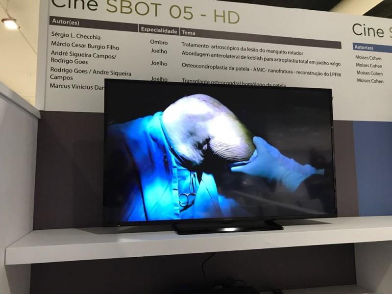 Cirurgia realizada no HSJosé é case de sucesso em Congresso Nacional