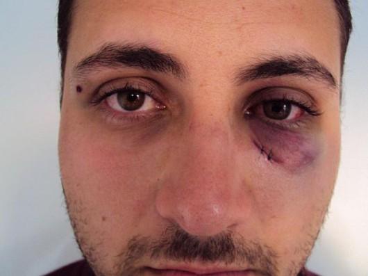 Estudante é espancado por colegas em corredor de colégio
