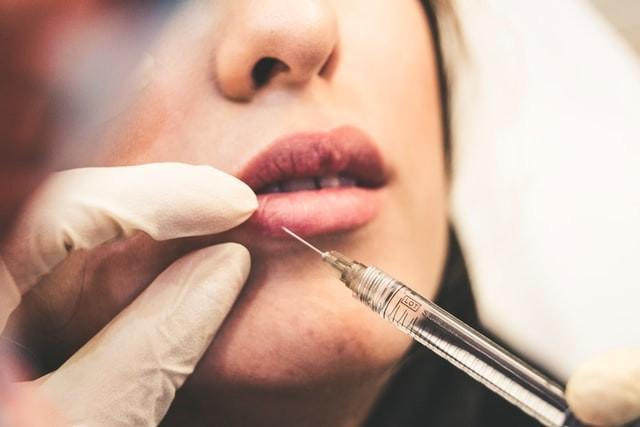 Botox ou Preenchimento? Entenda as diferenças entre esses dois procedimentos