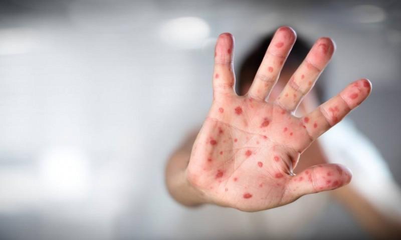 Infecção: diagnóstico e tratamentos