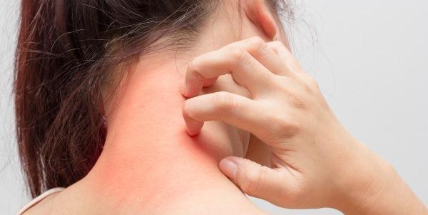 Coceira na pele nem sempre é uma doença dermatológica