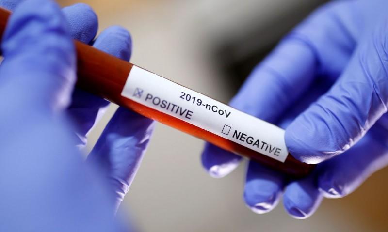 Anvisa aprova testes rápidos para Covid-19 em farmácias