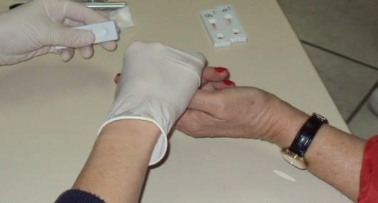 Exames de hepatites virais serão disponibilizados em Içara