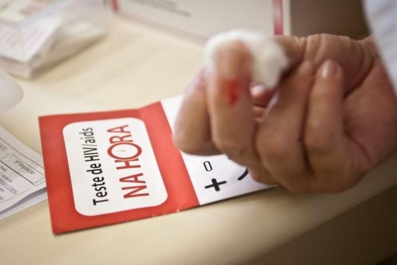 Avanços em prevenção reduzem incidência e mortes por Aids em SC