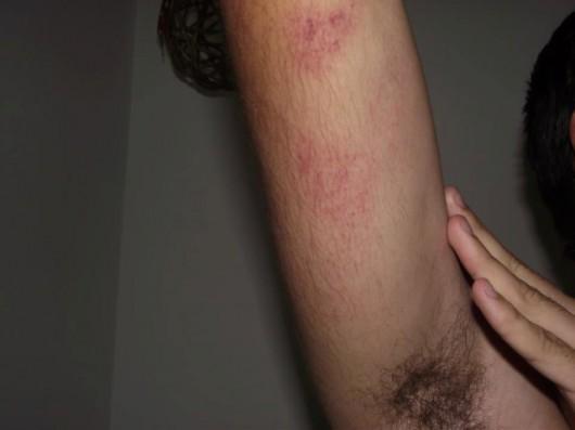 Guarda Municipal nega ter agredido estudante da Unesc