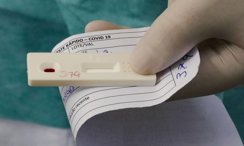 Brasil registra mais um dia acima dos 50 mil novos casos de Covid-19