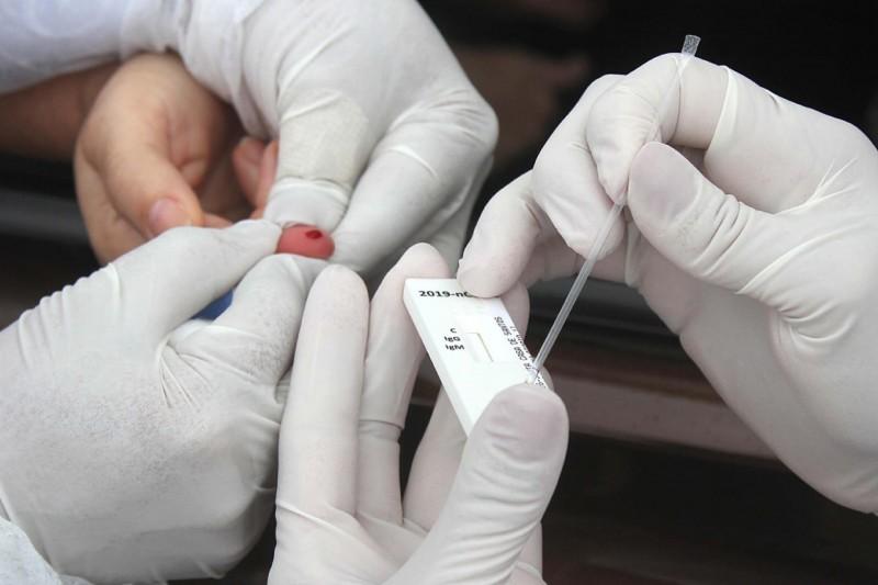 Covid-19: Morro da Fumaça irá adquirir 2 mil testes