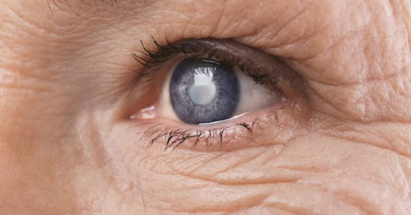 Dia de Combate ao Glaucoma alerta para prevenção à maior causa da cegueira