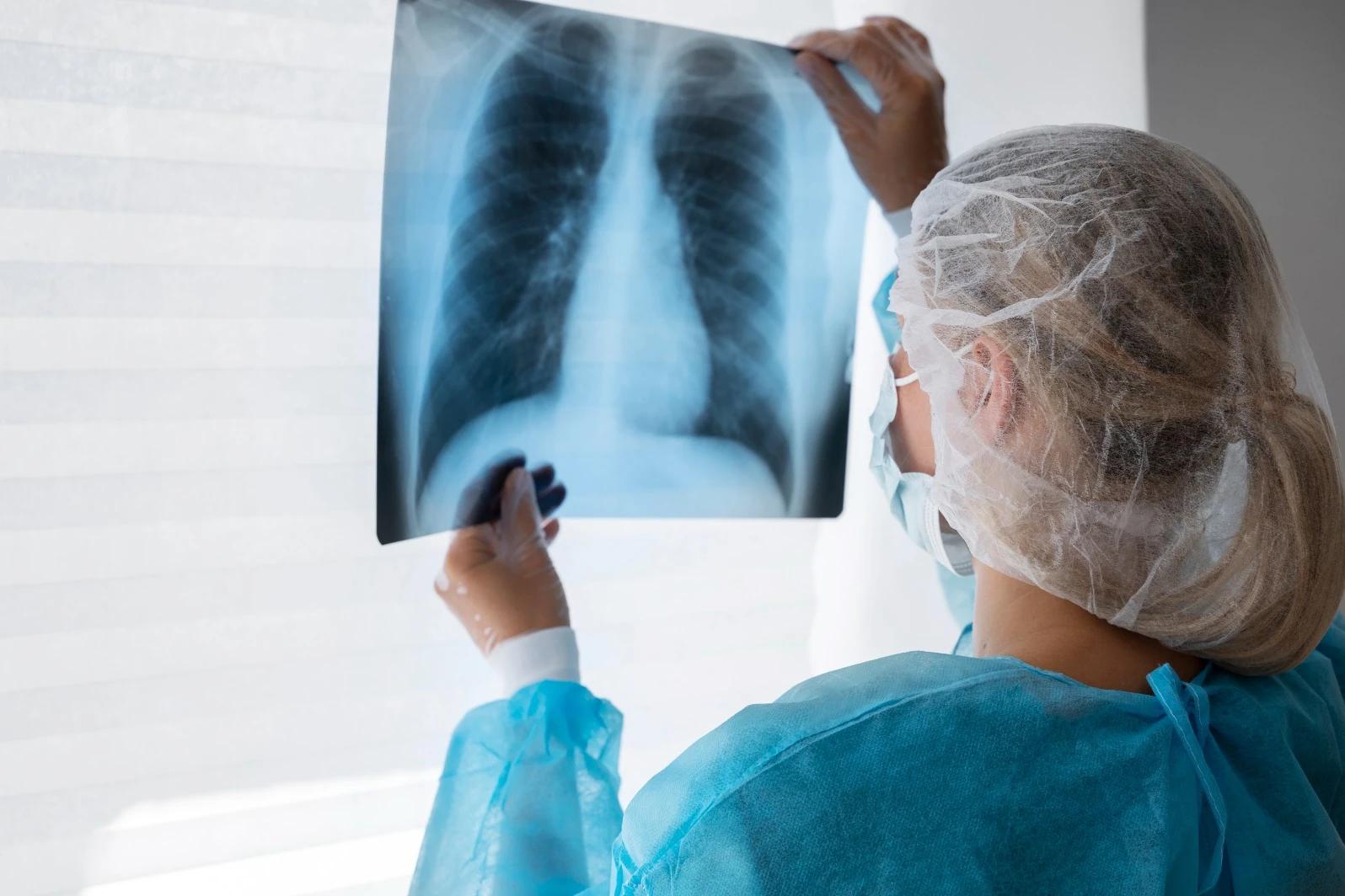 Serviço de diagnóstico por raio-x será implantado em Siderópolis
