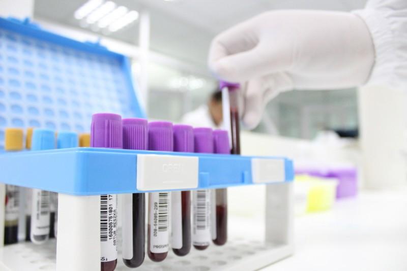 Testes de Covid-19 pelo Laboratório Búrigo apontam cerca de 15% de resultados positivos